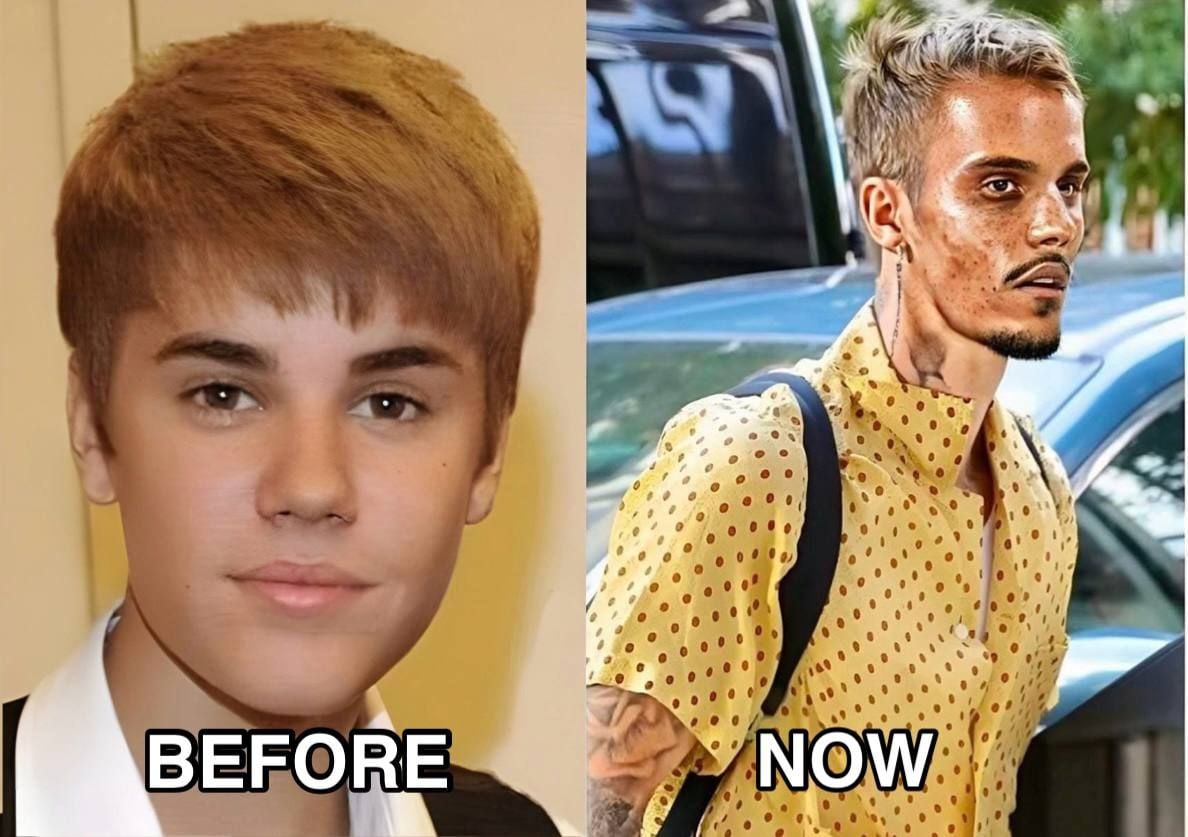 Justin Bieber admits that he tested positive for…See More…SH